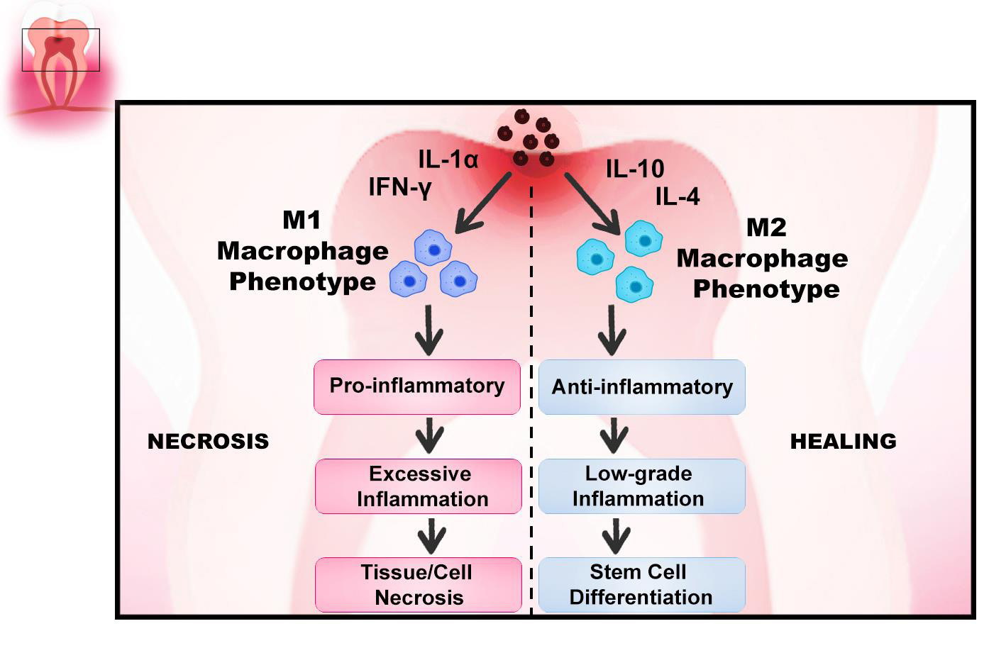 Figure 6: M1-M2 macrophage polarization is one of the key steps in tissue repair as they regulate dental pulp stem cell activation and inflammation.