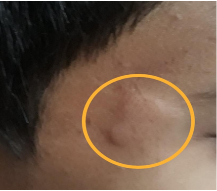Figure 1: Allergy.