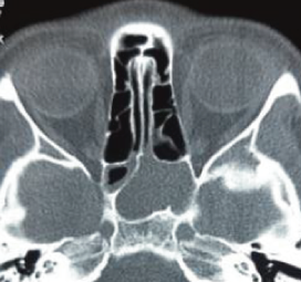 Figure 4: Axial view.