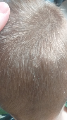 Figure 7: Clinical case 4 Before.