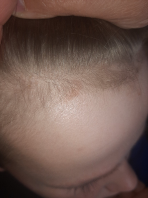 Figure 8: Clinical case 4. After.