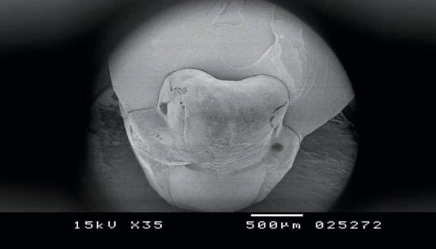 Figure 3: SEM image x 35 demonstrating restorable fracture (lava ultimate).