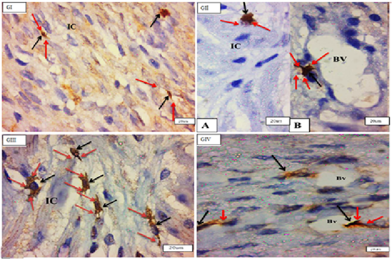 Figure 3: Photomicrographs of cross sections in the rat uterus myometrium (IC) layer showing many c-kit-positive cells telocytes (black arrows) with processes (telopodes) (red arrows), around blood vessels (BV) & in between muscle fibers (GI), (GII), (GIII), & (GIV) (C-kit immunohistochemistry counterstained with Hx, O.M, X1000).