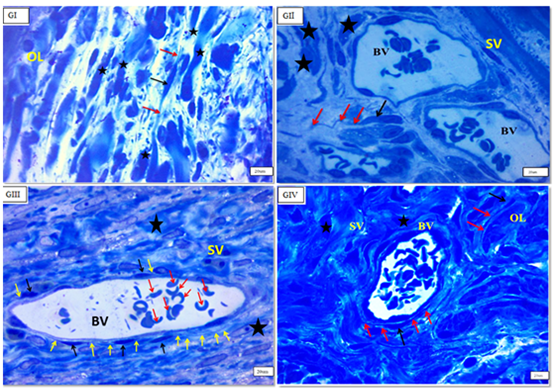 Figure 6: Photomicrographs of semithin of section in the myometrium of rat uterus showing telocytes (black arrows), telopodes(red arrows) in-between myocytes(star) in the (OL) layers, and around congested blood vessels (BV) in stratum vascular (SV) in (GI), (GII), (GIII) & (GIV). (Semithin, Toluidine blue, O.M, x1000).