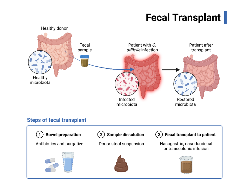 Figure 3: Stepwise diagram of FMT.