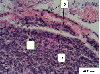 Figure 2: Morphological rearrangements of the pineal gland’s structural components under the condition of 60-days exposure to heavy metal salts and correction with α-tocopherol acetate: 1 - reactive glial response; 2 - aggregation and sludge of erythrocytes; 3 - increase in the severity of the gland’s trabecular connective tissue component. Hematoxylin-eosin staining.