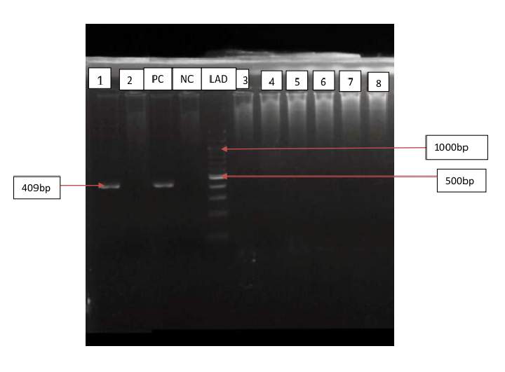 Figure 1: Picture of gel from PCR product of HBV S gene amplification (Band size=409). Lane 1 is a sample positive for HBV S gene from HBsAg-negative population. PC =positive control NC = negative control LAD= Ladder.