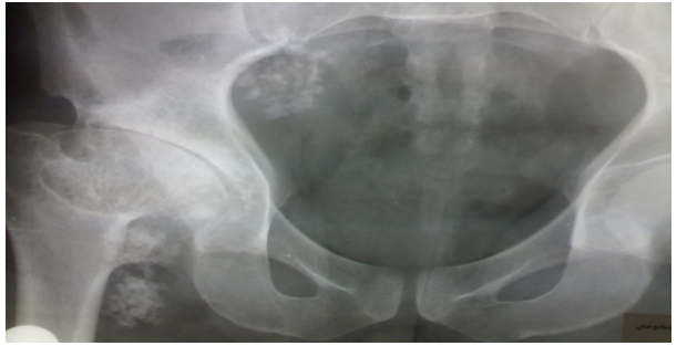 Figure 2: Plain abdominal radiograph.