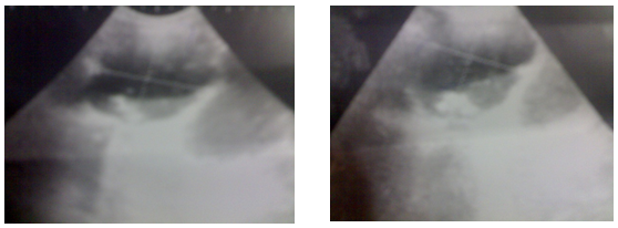 Figure 5: Abdominal and pelvic CT scan.