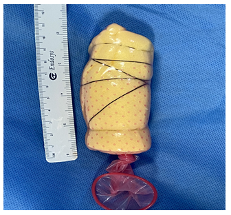 Figure 2: Spacer with condom.