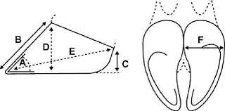 Figure 2: Distribution of the percentage of hind claws within each category of IDHE during 3 months after trimming in hind claws of primiparous cows in both trimming methods. IDHE was rated on a scale from 0 to 4 (0 = absent and 4 = severe).