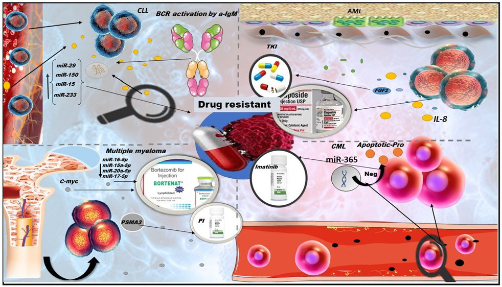 Figure 2: Extracellular vesicles and malignancy drug resistance. The role of extracellular vesicles as a factor in the development of therapeutic resistance in hematological malignancies; AML, CLL, CML, and MM are briefly presented. AML: due to the association between AML malignant cells and the bone marrow microenvironment, the released exosomes are packed with IL-8 and FGF-2 and caused resistance to etoposide and TKI, respectively. CLL: the activated BCR signal releases exosomes with miRNAs contents, such as miR-29, -150, -15, and -233 that reduce therapeutic response. MM: in myeloma patients, exosomes with various cargo cause failure to bortezomib and PI. For instance, low miRNA levels, such as miR-16-5p, 15a-5p, 20a-5p, 17- 5p, and c-myc [in patients with t (4; 14) and Del 17p] as a therapeutic agent against bortezomib and the others with PSMA3 against to PI. CML: miR-365 from exosomes released from malignant cells in CML causes resistance to imatinib by negatively affecting the expression of apoptotic proteins.