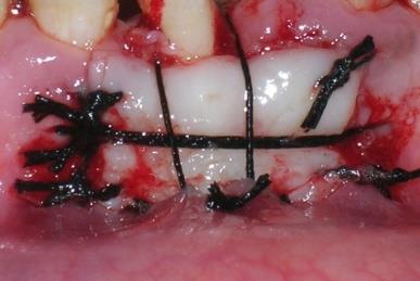 Figure 5: Posttreatment facial and intra-oral photographs.