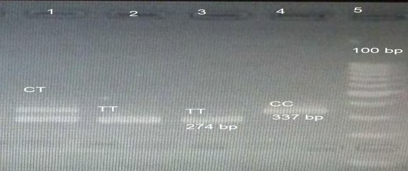Figure 2: TLR3 1377 C/T PCR products of FIVE samples. Lane (5) 100 bp ladder, sample in lane (1)CT genotppes & 2,3 TT genotype, lane 4 CC genotype.