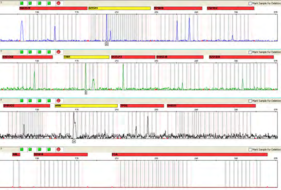 Figure 1: An electropherogram showing the partial or no peaks of the fluorescein-labeled loci: D8S1179, D21S11, D7S820, CSF1PO, D3S1358, TH01, D13S317, D16S539, D2S1338, D19S433, vWA, TPOX, D18S51, Amelogenin, D5S818, FGA.