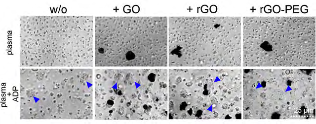 Figure 12: The effect of GO, rGO, and rGO-PEG on the platelet activation: Graphene Nano derivatives were co-incubated with platelet PTL rich plasma at 50µg/ml. Platelet activation was induced by the addition of 2µmol/ml of Adenosine Di-Phosphate (ADP). The Platelet PTL aggregates are pointed by the blue arrows. One representative picture reflects the results of 3 independent experiments. GO; rGO reduced graphene oxide; rGO-PEG, PEGylated reduced graphene oxide; ADP, adenosine-di- phosphate [27].