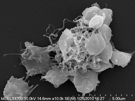 Figure 14: Scanning electron microscopy image shows platelet PTL activation by multi-walled CNTs (M60). Platelets were incubated with 100µg/ml of M60 at 37°C for 15 minutes under gentle agitation. The images are representative of at least three individual experiments with platelets PTL from different donors. (Image: Jan Simak, FDA).