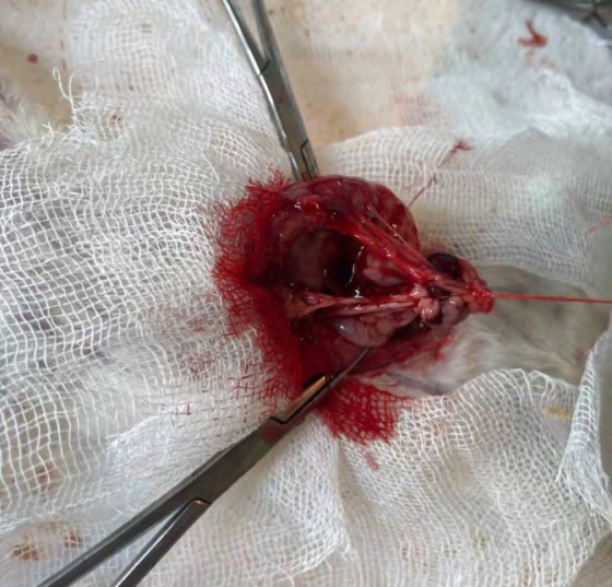 Figure 5: Small focus and necrosis, subcapsular accumulations of hemosider phages and red pulp leukocytes. Stained with hematoxylin and eosin. Ok.10. Ob.4.