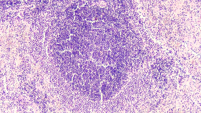 Figure 9
