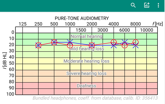 Figure 3: Hearing test android application screenshot.