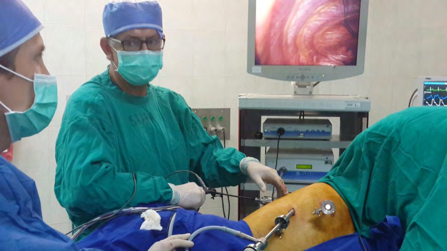 Figure 6: Video-thoracoscopy access. Trocar 1 10 mm, 30-degree camera Trocar 2 -3 5 mm.