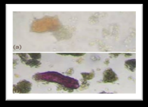 Figure 2: Daruharidra (a) Prismatic crystal (b) Fibre.