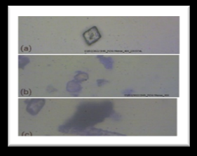 Figure 3: Pippali (a) oleoresin (b) stone cell & brown content.