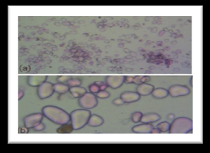 Figure 4: (a) Shunthi (b) Starch grains.