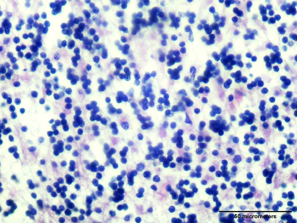 Figure 1: Cortex of human cerebellum, granule cell layer. Hematoxylin and eosin staining. Scale bar = 50 micrometers.