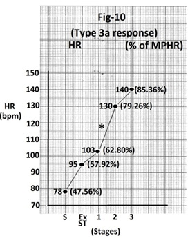 Figure 10: Graph of heart rate at the end of different stages of exercise of the person whose treadmill stress test report is shown in Figure 9. There is significant increase in heart rate (27 bpm) during stage 2 (marked). Abbreviations - HR- heart rate, bpm- beats per minutes, S- Supine, Ex ST - Exercise start, ST - Stage of stress, MPHR- percentage of age predicted maximal heart rate.