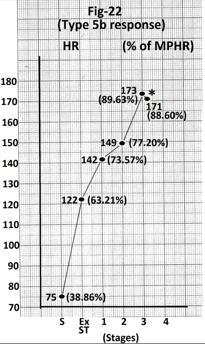 Figure 22: Graph of heart rate at the end of different stages of exercise of the person whose treadmill stress test report is shown in Figure 21. There is decrease of 2 beats per minute during stage 4(marked). Abbreviations- HR- heart rate, bpm- beats per minute, S- Supine, Ex ST - Exercise start, ST - Stage of stress, MPHR- percentage of age predicted maximal heart rate.