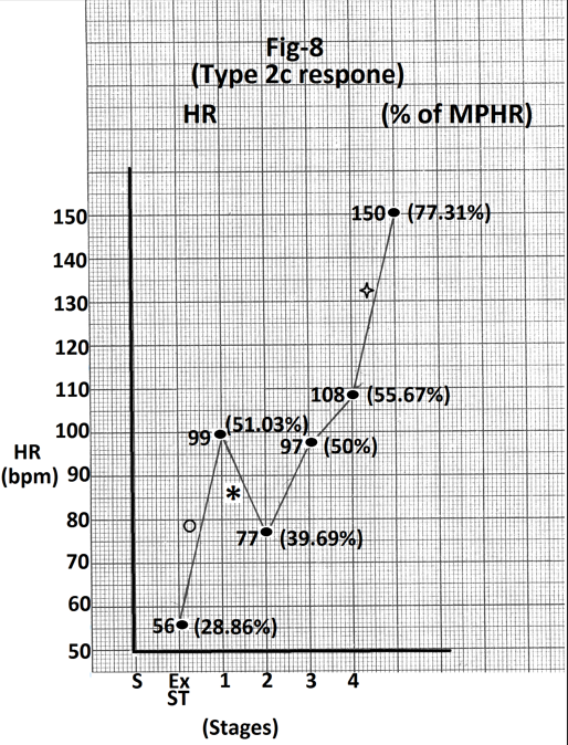 Figure 8: Graph of heart rate at the end of different stages of exercise of the person whose treadmill stress test report is shown in Figure 7. There is significant increase in heart rate from supine to pre-exercise (43 bpm) (marked ‘O’). There is decrease in heart rate (22 bpm) during stage 1(marked). There is significant increase in heart rate (42 bpm) again during stage 4 (marked). Abbreviations’ HR- heart rate, bpm- beats per minute, S- Supine, Ex ST - Exercise start, ST - Stage of stress.