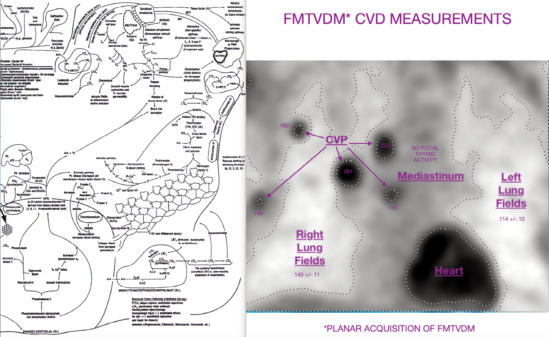 Figure 1: Inflammothrombotic interactions between infection, inflammation, interleukins, cytokines and the blood-clotting complement cascade. FMTVDM tissue measurement of the viral and InflammoThrombotic Response (ITR). Legend: The left half of the figure [5] shows the interactions between infectious agents, the complement clotting cascade, cytokines, interleukins, and glycoprotein IIb/IIIa as they worsen already existing InflammoThrombotic coronary artery (vascular) disease in addition to other inflammatory diseases including inter alia obesity, cerebrovascular (CVA) disease, diabetes, cancer, advanced age, and hypertension. The right half of the figure [8] shows FMTVDM measurement of regional differences in blood flow and metabolism at the tissue level resulting from SARS-CoV-2 and the associated ITR [FMTVDM U.S. patent # 9566037; NCT04349410; reference 11] making it possible to measure both the severity of SARS-CoV-2 as well as treatment success or failure.