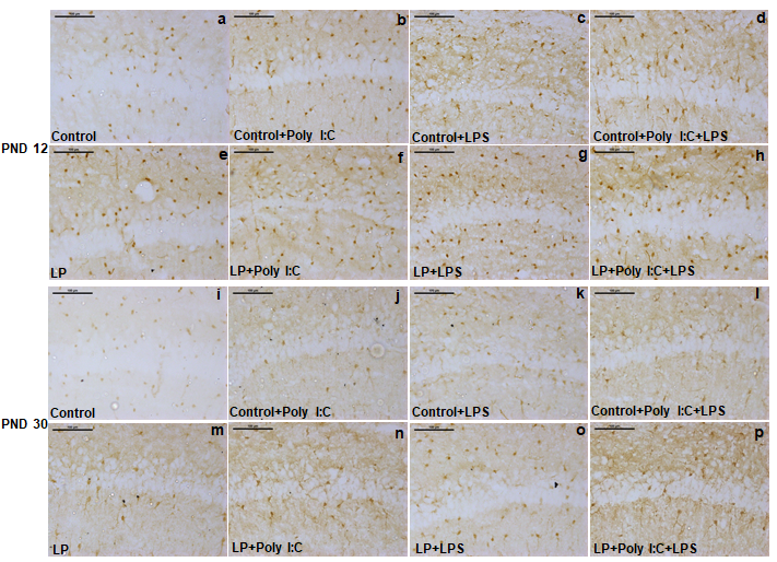 Figure 3: The S100β labeled images of PND 12 and 30 depicts vigorous hype in S100β protein expression mainly in multi-hit groups.