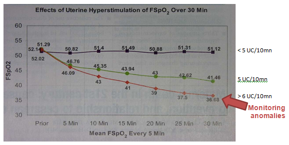 Figure 5: Effects of uterine hyper stimulation on fetal oxygen status and FHR pattern.