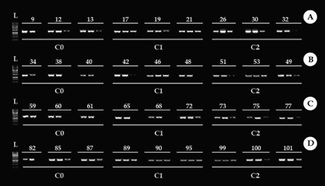 Figure 5: Methylation profile of the 18S ribosomal DNA gene (18S rDNA), in the brain. Times used in the experiment 24h, 48h, 72h, and 96h (A, B, C D, respectively). C0: control condition. C1: concentration 1, 30% of Trichlorfon LC50-96h diluted in water (0.261 mg/L). C2: concentration 2, 50% of Trichlorfon LC50-96h diluted in water (0.435 mg/L). First column: ladder.
