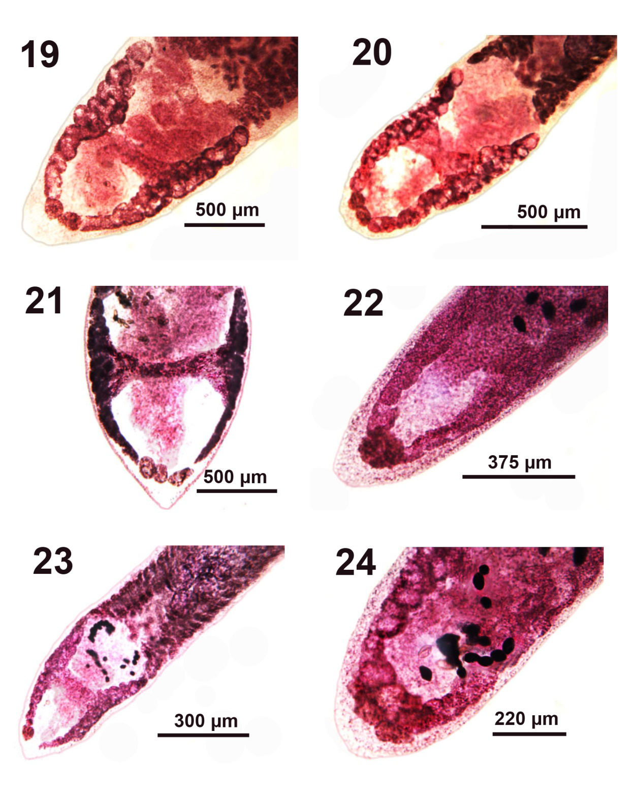Figure 4: 6. A developing scolex of an older juvenile showing undefined loculi and no terminal disc.