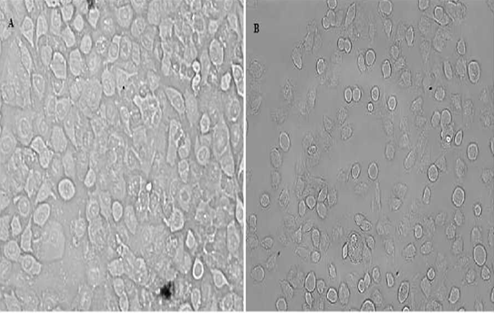 Figure 1: Heavy Metal Free SKBR3 Cells (A) 13ug / Ml (IC50 Value) Cadmium Treated SKBR3 Cells.