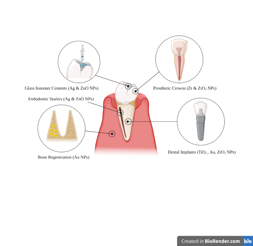 Figure 1: Various Applications of Nanomaterials in Dentistry. other Applications are Denture Base Resins (Zr, Zro2 & Ag Nps), Toothbrushes (Ag Nps), And Biosensors (Zr Nps).