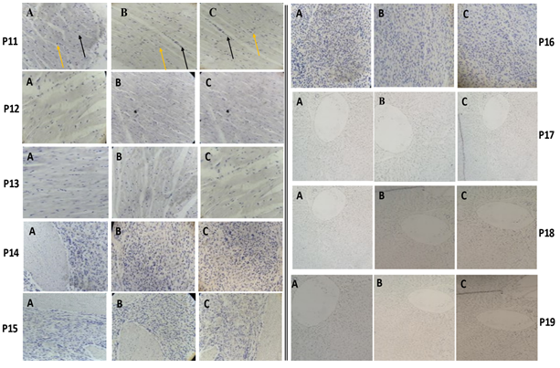 Figure 2: P11-Photomicrograph of cattle heart section stained with haematoxylin and counterstained with 20% ethanolic dye extract of kola nut for A. 5 min; B. 10 min; C. 15 min. Cytoplasmic staining observed as greyish-brown colouration. Nuclei stained blue-black (black arrow) and cytoplasm stained grey to golden brown (yellow arrow) Magnification x200. P12- Photomicrograph of cattle heart section stained with haematoxylin and counterstained with 20% ethanolic dye extract of kola nut for A. 5 min; B. 10 min; C. 15 min. Cytoplasmic staining observed as greyish -brown colouration. Nuclei stained blue-black (black arrow) and cytoplasm stained grey to golden brown (yellow arrow) Magnification x200. P13-Photomicrographs of cattle heart tissue sections stained with haematoxylin and counterstained with 60% ethanolic dye extract of kola nut for A. 5 min; B. 10 min; C. 15 min (cytoplasmic staining observed as grayish-brown colouration with intense and distinct staining pattern). Magnification x200. P14-Photomicrographs of cattle spleen tissue sections stained with haematoxylin and counterstained with 20% ethanolic dye extract of kola nut for A. 5 min; B. 10 min; C. 15 min. (cytoplasmic staining observed as golden-brown colouration with increasing intensity relative to staining time). Magnification x200. P15-Photomicrographs of cattle spleen tissue sections stained with haematoxylin and counterstained with 40% ethanolic dye extract of kola nut for A. 5 min; B. 10 min; C. 15 min. (cytoplasmic staining observed as golden-brown colouration with relatively uniform staining intensity). Magnification x200. P16-Photomicrographs of cattle spleen tissue sections stained with haematoxylin and counterstained with 60% ethanolic dye extract of kola nut for A. 5 min; B. 10 min; C. 15 min. (cytoplasmic staining observed as golden- brown colouration with relatively uniform staining intensity). Magnification x200. P17-Photomicrographs of cattle liver tissue sections stained with haematoxylin and counterstained with 20% ethanol dye extract of kola nut for A. 5 min; B. 10 min; C. 15 min. (cytoplasmic staining observed as grayish-brown colouration with relatively uniform staining intensity). Magnification x100. P18-Photomicrographs of cattle liver tissue sections stained with haematoxylin and counterstained with 20% ethanol dye extract of kola nut for A. 5 min; B. 10 min; C. 15 min. (cytoplasmic staining observed as golden-brown colouration with relatively uniform staining intensity). Magnification x100. P19-Photomicrograph of cattle Liver section. Stain: Haematoxylin and counterstained with 60% ethanol dye extract of kola nut stained for A. 5 minutes; B. 10 min; C. 15 min (cytoplasmic staining observed as golden-brown colouration with relatively uniform staining intensity). Magnification x100.