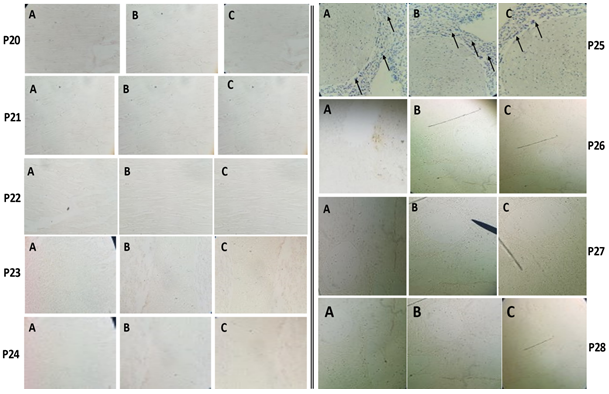 Figure 3: P 20-Photomicrographs of cattle heart tissue sections stained with haematoxylin and counterstained with 20% distilled water dye extract of kola nut for A. 5 min; B. 10 min; C. 15 min. (cytoplasmic staining observed as the grayish -brown colour). Magnification x100. P 21-Photomicrographs of cattle heart tissue sections stained with haematoxylin and counterstained with 40% distilled water dye extract of kola nut for A. 5 min; B. 10 min; C. 15 min. (cytoplasmic staining observed as the grayish brown colour). Magnification x100. P 22-Photomicrographs of cattle heart tissue sections stained with haematoxylin and counterstained with 60% distilled water dye extract of kola nut for A. 5 min; B. 10 min; C. 15 min. (cytoplasmic staining observed as the greyish- -brown colouration). Magnification x100. P23- Photomicrographs of cattle tissue Spleen sections stained with haematoxylin and counterstained with 20% distilled water dye extract of kola nut for A. 5 min; B. 10 min; C. 15 min (cytoplasmic staining observed as golden- brown colouration). Magnification x200. P24- Photomicrographs of cattle tissue spleen sections stained with haematoxylin and counterstained with 40% distilled water dye extract of kola nut for A. 5 min; B. 10 min; C. 15 min (cytoplasm observed as golden-brown colour). Magnification x200. P25- Photomicrographs of cattle tissue spleen sections stained with haematoxylin showing blue nuclear staining (arrows) and counterstained with 60% distilled water dye extract of kola nut for A. 5 min; B. 10 min; C. 15 min (cytoplasm observed as golden-brown colour). Magnification x100. P26- Photomicrographs of cattle liver tissue sections stained with haematoxylin and counterstained with 20% distilled water dye-extract of kola nut stained for A. 5 min. B. 10 min. C. 15 min, (cytoplasm observed as light brownish colouration). Magnification x40. P27- Photomicrographs of cattle liver tissue sections stained with haematoxylin and counterstained with 40% distilled water dye-extract of kola nut stained for A. 5 min. B. 10 min. C. 15 min. (cytoplasm observed as the light brownish colour). Magnification x40. P28- Photomicrographs of cattle liver tissue sections stained with haematoxylin and counterstained with 60% distilled water dye-extract of kola nut stained for A. 5 min. B. 10 min. C. 15 min. (cytoplasm observed as light brownish colouration). Magnification x40