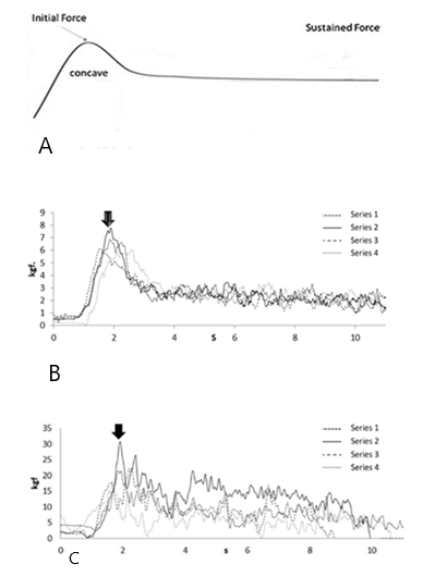 Figure 1: Graphs showing examples of force measurements when pulling. The black arrow indicates the highest peak force detected in the initial phase. A) Theoretical/ideal case. B) Example 1: Push/pulling on even surface (smooth asphalt) with moderate force fluctuations. C) Example 2: Push/pulling on uneven surface with significant force fluctuations.