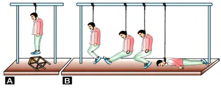 Figure 3: Types of Hanging A: Complete Hanging and B: Partial hanging.