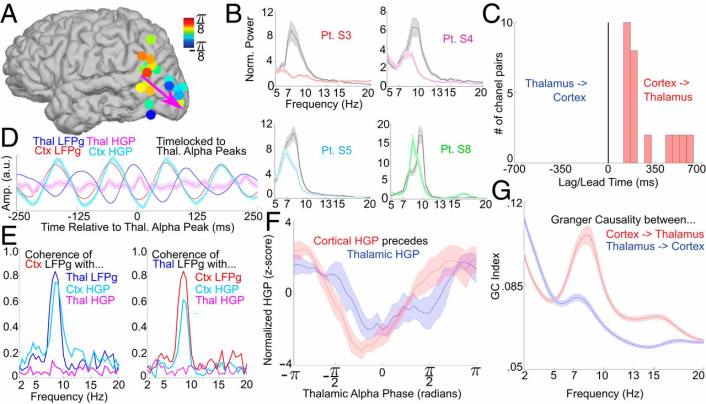 Figure 4: Figure illustrates Cortical alpha leads thalamic (pulvinar) alpha. (A) Average alpha-phase lag/leads in bipolar contacts (n = 5). Note that anterosuperior channels lead inferoposterior ones, in accord with our ECoG recordings. (B) Power spectra of the thalamic (color) and cortical (gray) channel with the greatest alpha power. (C) The difference in start times between all cortical and thalamic alpha bursts (start time in thalamus to start time in cortex) in the 28 channel pairs with a significant thalamic or cortical lead (P < 0.05, Bonferroni corrected, binomial test). Alpha bursts start (on average) in cortex for all 28 channel pairs. (D) Cortical and thalamic LFPg and HGP from representative channels locked to peaks in thalamic alpha LFPg—cortical, but not thalamic, HGP is phasic with thalamic LFPg. (E) Coherence spectra of thalamic and cortical LFPg with thalamic and cortical HGP and LFPg from the same channel pair in D; the coherence of thalamic LFPg with cortical HGP (but not thalamic HGP) suggests that the cortex may drive thalamic alpha activity. (F) Normalized thalamic and cortical HGP at different thalamic alpha phases averaged across channels; note that cortical HGP slightly leads thalamic HGP. (G) GC spectra averaged over all thalamocortical contact pairs; corticothalamic causality shows a strong alpha peak. Amp., amplitude; a.u., arbitrary units; ctx, cortical; norm., normalized; thal, thalamic [11].