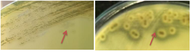 Figure 3: CPSA on BPET with acriflavine showing growing of black colonies with halo zone (arrows).