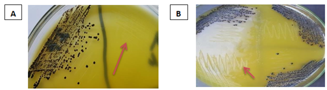 Figure 4: CPSA (A) and CNSA (B) on BPET with acriflavine showing growing of black colonies, while other staph. spp. can’t grow (arrows).