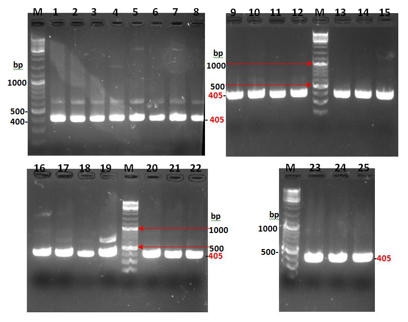 Figure 1: Products of polymerase chain reaction performed with UreR gene of P. mirabilis isolated from urinary stones patients. M: 100 bp DNA ladder, Lane 1-25: Amplified PCR product of UreR gene.