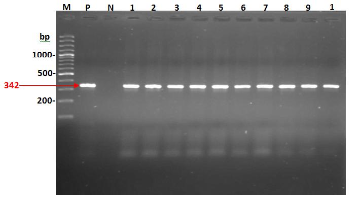Figure 3: Also, according to the product size of primers the results showed that the O- antigen of P. mirabilis was Wzy genes.